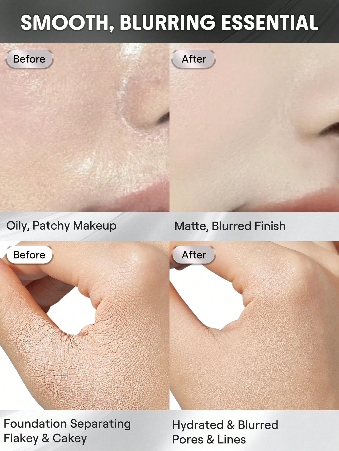 SHEGLAM Pore-minimising base